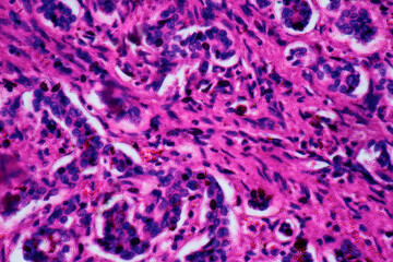 ill human liver cells of biliary cirrhosis