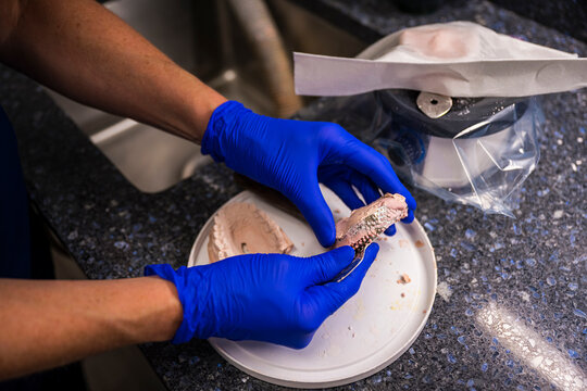 Custom Oral Mouth Mold being made with Plaster