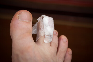 Human leg with a wound on the second toe. The wound was tied with a bandage and glued with adhesive plaster.