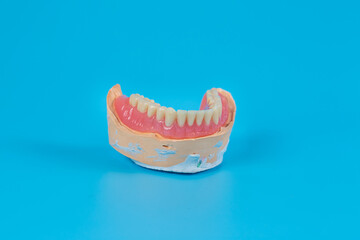 Artificial jaw, visual aid for dentists and patients on a blue background.