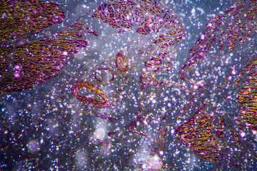 micrograph of human coronary artery atherosclerosis cells