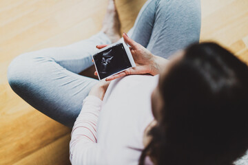 Pregnant woman holding ultrasound image