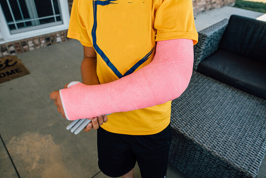 Boy showing off broken arm.