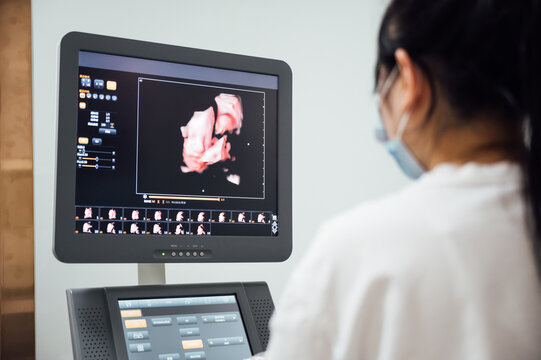Doctor reviewing ultrasound picture