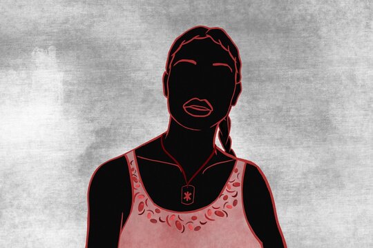 Anonymous woman with sickle cell