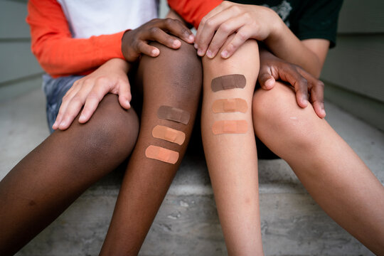 multiracial brothers with multicolored bandages on legs sit on front steps