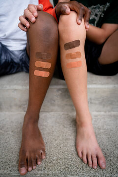 Multiracial brothers with multicolored bandages on legs