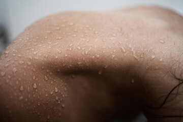Raindrops on skin