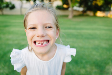 A girl without one of her baby tooth