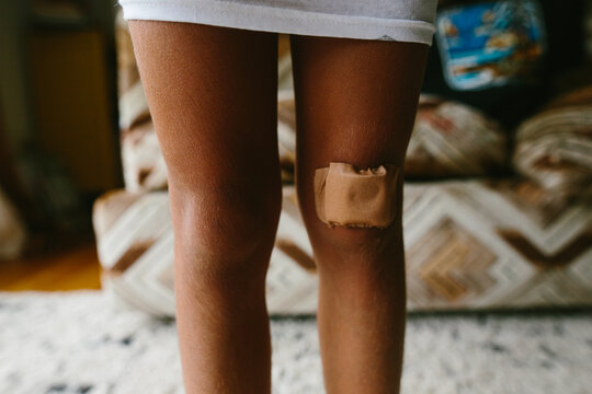 child with bandages on scrapes