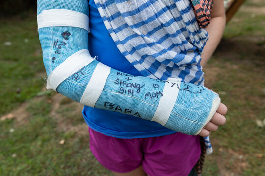 Young Girl With Cast on Broken Arm