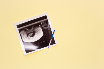 A positive pregnancy test strip and an ultrasound image of the fetus. Conception concept, waiting for the birth of a child, family