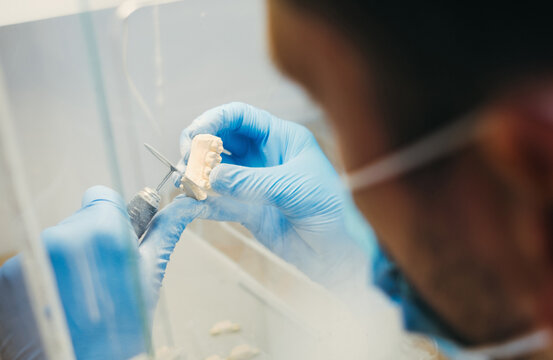 Dental Technician Making New Dental Prosthetics in Laboratory.