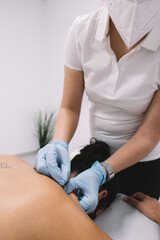 Female physiotherapist doing a dry needling technique