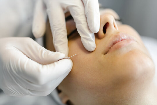 Cosmetic treatment