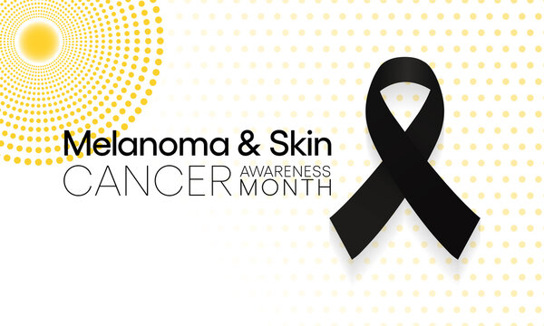 Melanoma and skin cancer awareness month observed each year in May, Exposure to ultraviolet (UV) rays causes most cases of melanoma, the deadliest kind of skin cancer. Vector illustration.