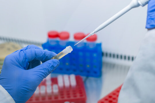 Close-up, a scientist holds an open small test tube in his hand and an automatic dispenser in the other hand against the background of laboratory racks.