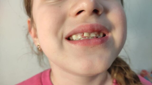 Little girl child wobbling her baby tooth