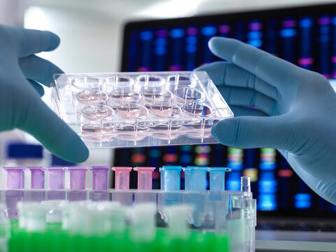 Scientist pipetting DNA samples into microcentrifuge tubes during an experiment in the laboratory with the DNA profile on the monitor screen.