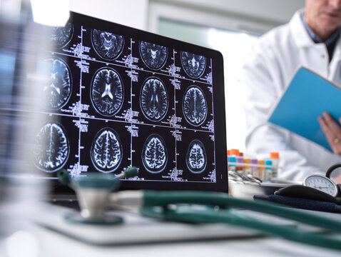 Close up of stethoscope and brain scan on a computer screen, scientist in background.