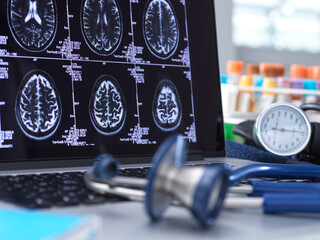 Close up of stethoscope and brain scan on a computer screen.