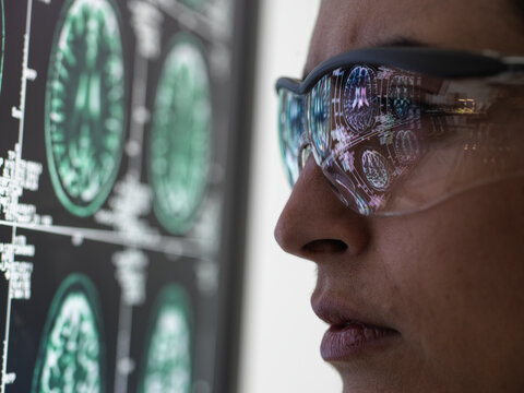 Neurology Diagnosis, Human brain scan on a screen being analysed by a female doctor in a neurology clinic.