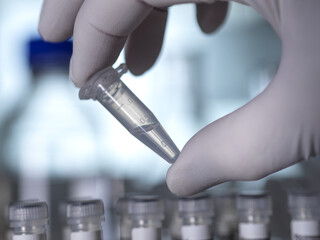 Scientist preparing DNA samples ready for automated analysis in the lab handling eppendorf tubes.