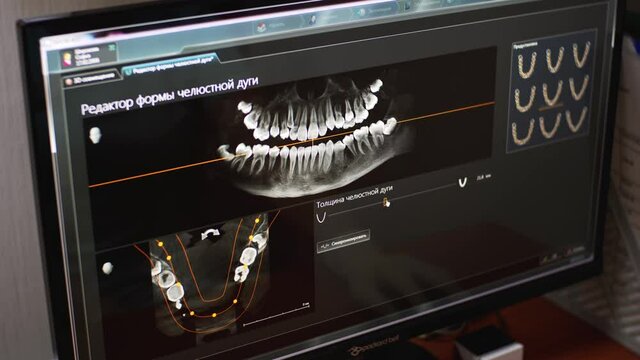Dentist is working with radiology x-ray of upper and lower jaws on computer display