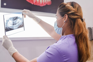 A female doctor checking a radiography x-ray. Una odontóloga revisando una radiografía.	