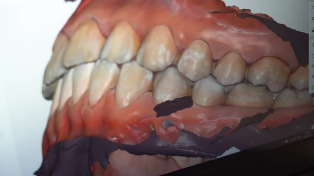Dental consultation, diagnostics. Jaw scanning, digital imprint, medical digital technology.