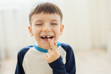 Little boy lost his first milk tooth.
