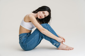 Young woman with vitiligo looking at camera while sitting on floor