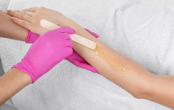 A beautician makes a sugar paste depilation of a woman's arms in a beauty salon.
