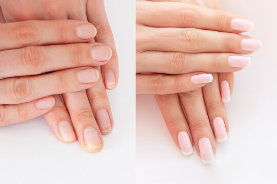 Before and after nail extension. Natural french manicure. Long nails extension, female hands