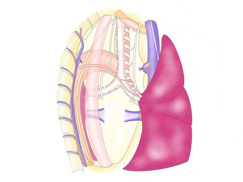 Esophagectomy surgical record