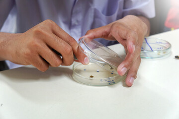 The hand was holding the filter paper tongs onto the prepared petri dish. Tests for the ability to...