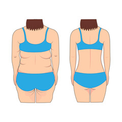 Woman's back before and after weight loss. Vector illustration.