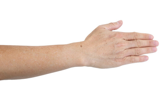 Small white and brown spots on the skin of senior man arm (Idiopathic guttate hypomelanosis).  Isolated on white background.