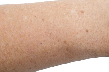 Small white and brown spots on the skin of senior man arm (Idiopathic guttate hypomelanosis).  Isolated on white background.