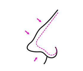 vector illustration of rhinoplasty. cosmetic surgery. aesthetic medicine. vector