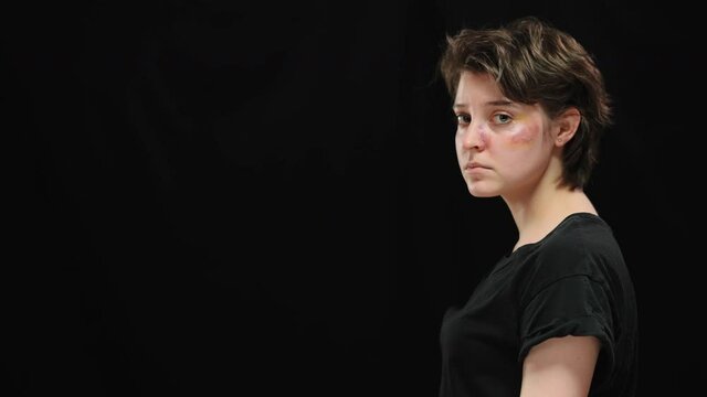 Young abused woman with beaten face in bruises standing on black background turning to camera and looking with desperate facial expression. Victim of domestic violence and tyranny.