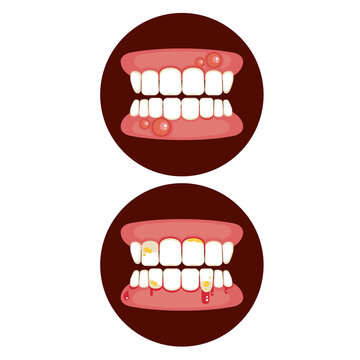 swollen gum icon