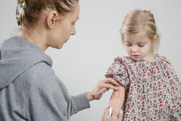 Mother applaying ointment onto red and itchy eczema on her daughter's arm. Toddler girl suffering...