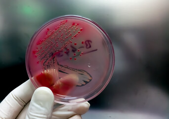 Gloved Hand of a Technician or scientist holding petri dish in the background of a microbiology...