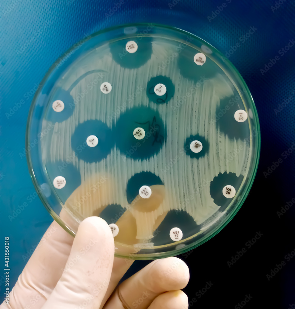 Poster Antimicrobial susceptibility testing in petri dish. Antibiotic resistance of bacteria