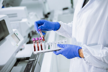 Scientist wear glove holding test tube in sample rack to check qulity of sample.