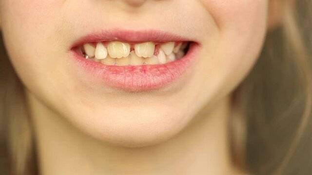 Unrecognizable girl touching loose tooth, close-up, lower part of face, 7 year old girl shows milk teeth and growing permanent. Soft selective focus. Macro. Child health and development concept