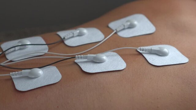 Physiotherapy of the back with TENS myostimulator, electrical nerve stimulation. Electrodes on the patient's back. The electrodes are designed for treatment, rehabilitation and tonicity.