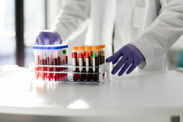 Healthcare professional with blood test tube samples in rack