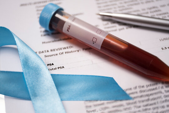 Close-up of prostate cancer blue ribbon and blood sample